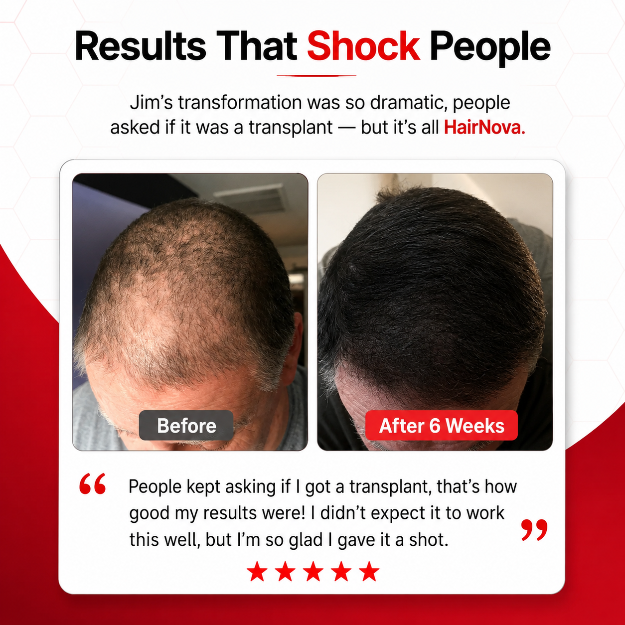 HairNova™ Pro Laser Cap